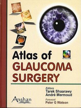 Atlas of Glaucoma Surgery pdf epub mobi 电子书 下载