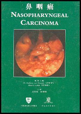 鼻咽癌 pdf epub mobi 下载