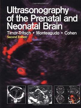 Ultrasonography of the Prenatal and Neonatal Brain pdf epub mobi 电子书 下载