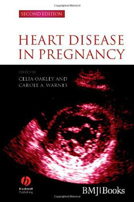 Heart Disease in Pregnancy pdf epub mobi 电子书 下载