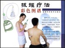 拔罐疗法彩色图谱