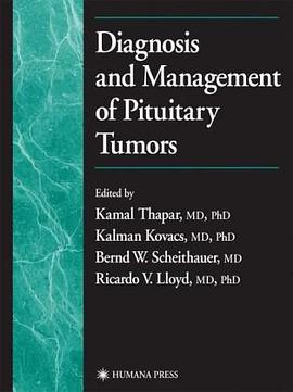Diagnosis and Management of Pituitary Tumors pdf epub mobi 电子书 下载