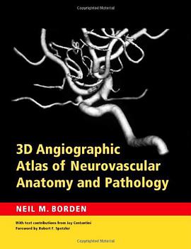 3D Angiographic Atlas of Neurovascular Anatomy and Pathology