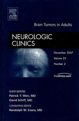 Brain Tumors in Adults, An Issue of Neurologic Clinics (The Clinics pdf epub mobi 电子书 下载