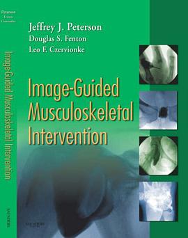 Image-guided Musculoskeletal Intervention pdf epub mobi 电子书 下载