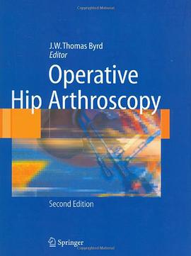 Operative Hip Arthroscopy pdf epub mobi 电子书 下载