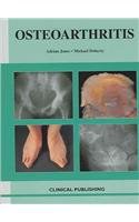 Osteoarthritis pdf epub mobi 电子书 下载