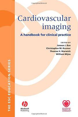 Cardiovascular Imaging pdf epub mobi 电子书 下载