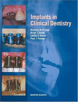 Implants in Clinical Dentistry pdf epub mobi 电子书 下载