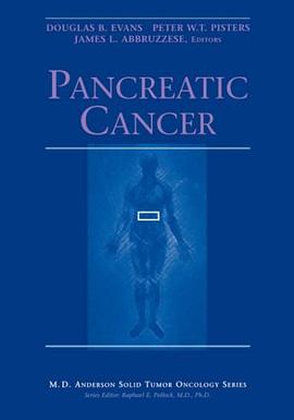 Pancreatic Cancer pdf epub mobi 電子書 下載