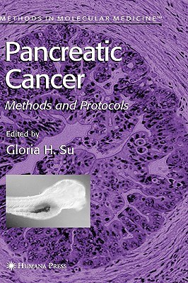 Pancreatic Cancer pdf epub mobi 电子书 下载