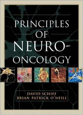 Principles Of Neuro-oncology pdf epub mobi 电子书 下载