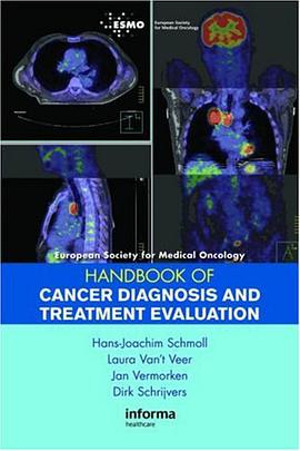 ESMO Handbook of Cancer Diagnosis and Treatment Evaluation