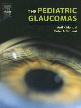 小儿青光眼The Pediatric Glaucomas pdf epub mobi 电子书 下载