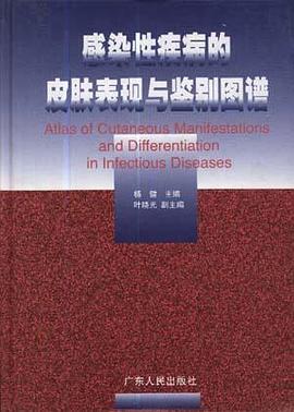 感染性疾病的皮肤表现与鉴别图谱 pdf epub mobi 电子书 下载