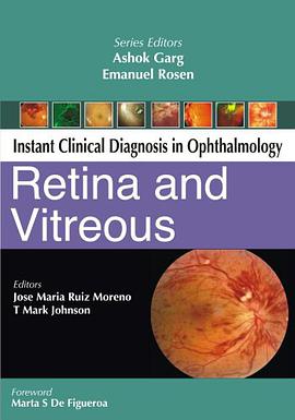 Retina and Vitreous pdf epub mobi 電子書 下載