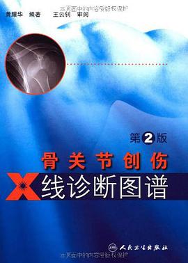 骨关节创伤X线诊断图谱 pdf epub mobi 电子书 下载