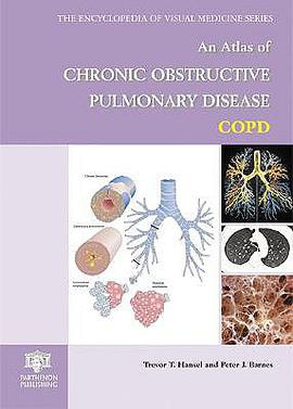 An Atlas of Chronic Obstructive Pulmonary Disease pdf epub mobi 下载