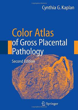 Color Atlas of Gross Placental Pathology pdf epub mobi 电子书 下载