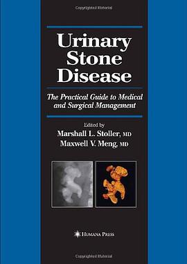 Urinary Stone Disease pdf epub mobi 电子书 下载