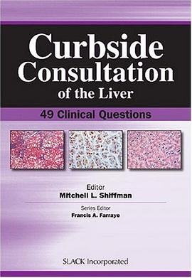 Curbside Consultation of the Liver pdf epub mobi 电子书 下载