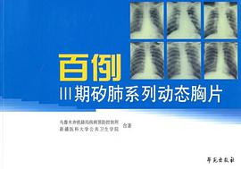 百例III期矽肺系列动态胸片 pdf epub mobi 电子书 下载