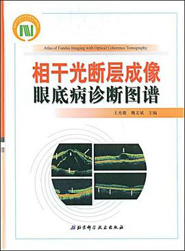 相干光断层成像眼底病诊断图谱 pdf epub mobi 电子书 下载