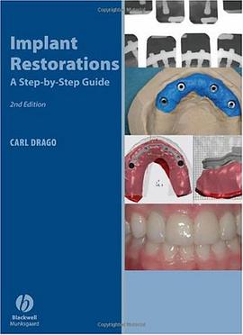 Implant Restorations pdf epub mobi 电子书 下载